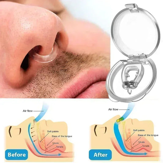 Anti-Snoring Corrector Snore Prevention Gadget Women's Anti-Snore Device Snore Elimination Nose Clip Men's Sleep Night - The Real Droppshipping